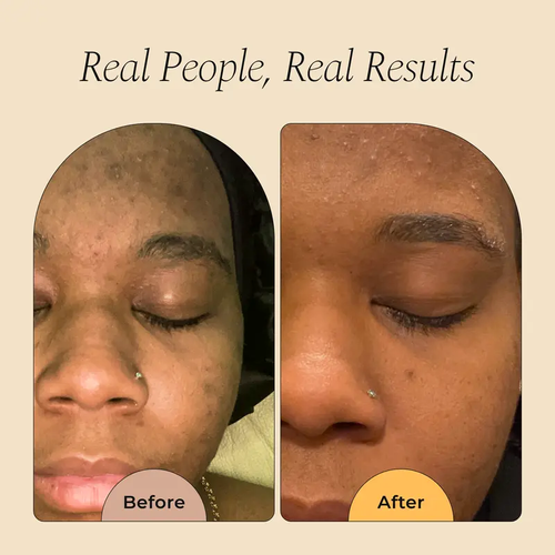 Turmeric Brightening Soap