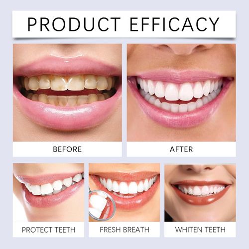 7.5% Hydroxyapatite Toothpaste(Fluoride Free), Nano Hydroxyapatite Toothpaste for Sensitive Teeth, Enamel Protection, Tooth Strengthening, Fresh Mint Flavor, Daily Use for Oral Care