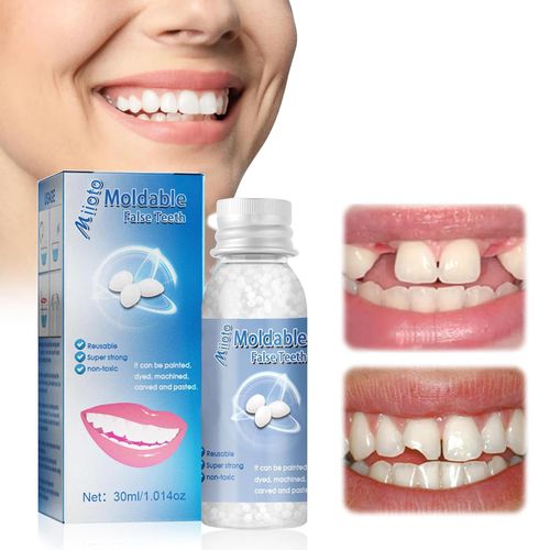 Moldable False Teeth Tooth Repair Granules, Teeth Repair Kit, DIY Temporary Tooth Repair Beads, for Temporary Fixing The Missing and Broken Tooth Replacements