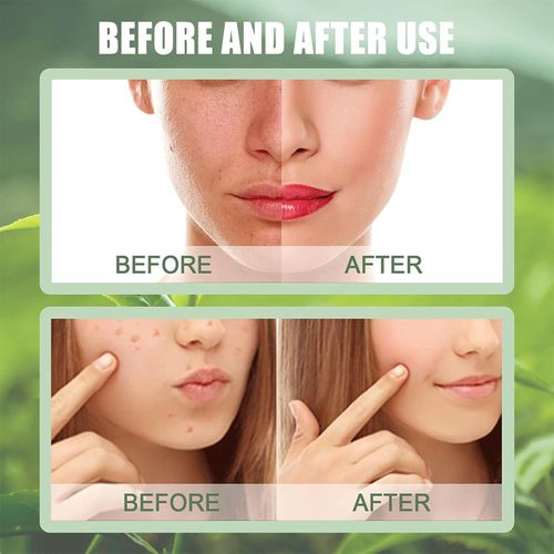 Juxek Green Tea Mask, Green Tea Deep Cleanse Mask, Green Tea Deep Cleanse Mask Stick Blackhead Remover, Green Tea Deep Cleanse Mask Juxek, Juxek Green Tea Face Mask (2pc)