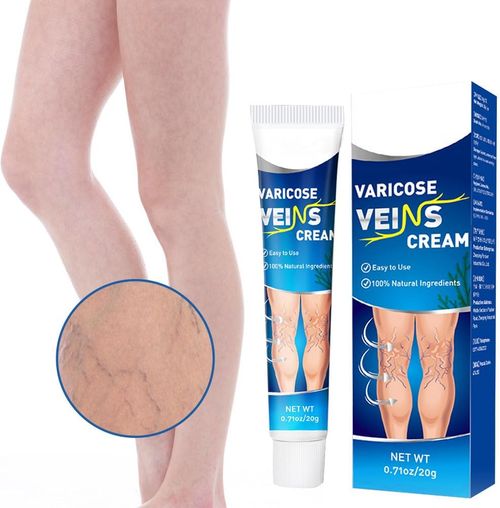 Varicose vein cream, leg care ointment, suitable for leg care, shimmering legs for men and women, 20g