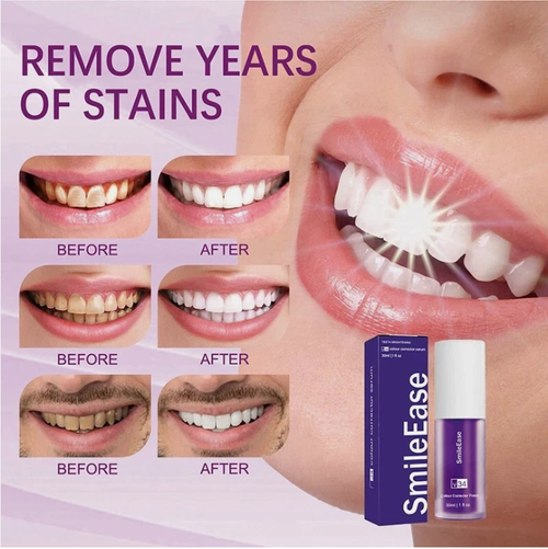 Teeth cleaning and whitening removes stains and whitens teeth 2025 new products
