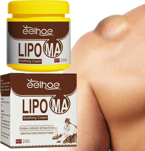 Eliminating lipomas, anti-lipomas, natural lipomas, skin conditions, eliminating intermediate lipomas, and eliminating various types of accumulated lipomas.