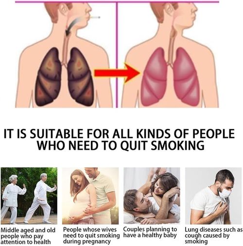 Smoking cessation patches, long-lasting smoking cessation patches, help you quit smoking, smoking control patches help cleanse your lungs, assisting in scientific smoking cessation (20 patches per pack).