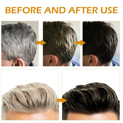 Gray Hair Reverse Bar Black Soap For Gray Hair Darkening Shampoo Bar, Natural Black Soap for Hair , Beard Darkening, Moisturizing  and Scalp Care for Men Women