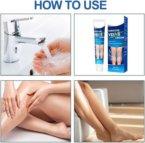 Varicose vein cream, leg care ointment, suitable for leg care, shimmering legs for men and women, 20g