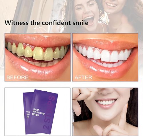 Purple Teeth Whitening Strips, Effectively Removes Surface Stains and Natural Shine28PCS