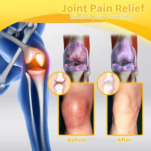 Bee Venom Cream, Bee Venom Pain Relief Bone Healing Cream, Bee Venom Treatment Cream, Bee Venom Cream for Arthritis, Bee Venom Cream, for Back, Neck, Hands, Knee (1 PCS)
