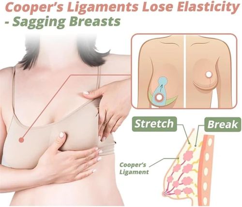 Breast Enhancement Patch, Breast Enhancement Mask, Breast Growth Patches, Breast Firming Patch for Improve Sagging (2Box)