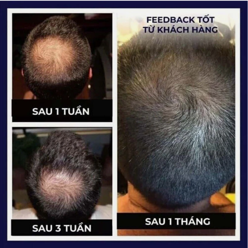 2 pieces of FEG Plus Organic Anti-Hair Loss Treatment Oil Spray for Thick Long Hair