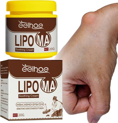 Eliminating lipomas, anti-lipomas, natural lipomas, skin conditions, eliminating intermediate lipomas, and eliminating various types of accumulated lipomas.