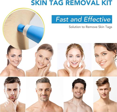 2 in 1 Skin Tag Remover Kit, (2mm to 8mm) Skin Tag and  Moles Removal Kit, Auto Skin Tag Remover Pen, Painless Skin Tag Mole Wart Removal Kit for All Body Parts