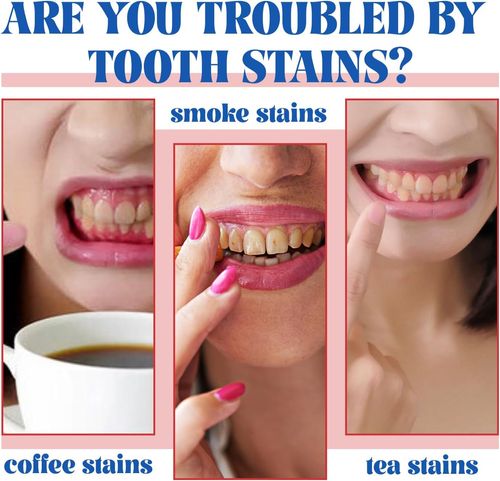 7.5% Hydroxyapatite Toothpaste(Fluoride Free), Nano Hydroxyapatite Toothpaste for Sensitive Teeth, Enamel Protection, Tooth Strengthening, Fresh Mint Flavor, Daily Use for Oral Care