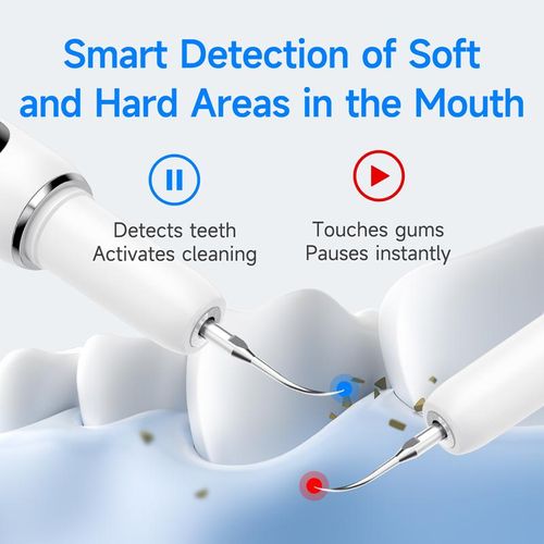 Ultrasonic Teeth Cleaner: Deep Clean Plaque, Stains & Bad Breath – 5 Modes, Portable & Gum-Safe!