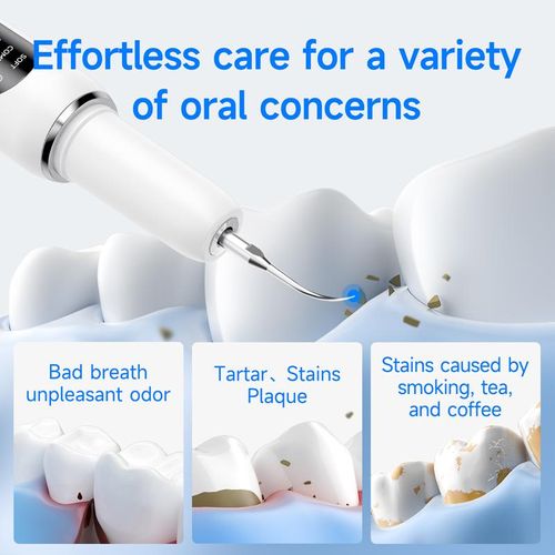 Ultrasonic Teeth Cleaner: Deep Clean Plaque, Stains & Bad Breath – 5 Modes, Portable & Gum-Safe!