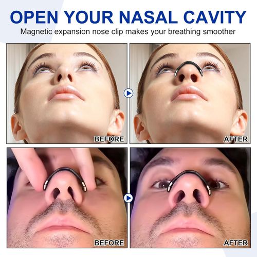 💥Magnetic Nose Strips😘