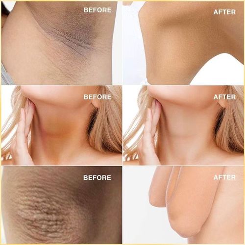 Kojic Acid Soap Philippine Kojic Acid Soap Papaya Soap Handmade Facial Cleansing Soap Bath Soap