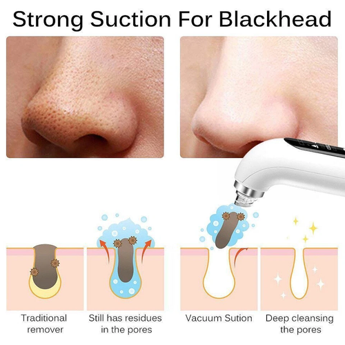 Electric Blackhead Remover Pore Vacuum Face Cleaner Pimple Black Head Removal