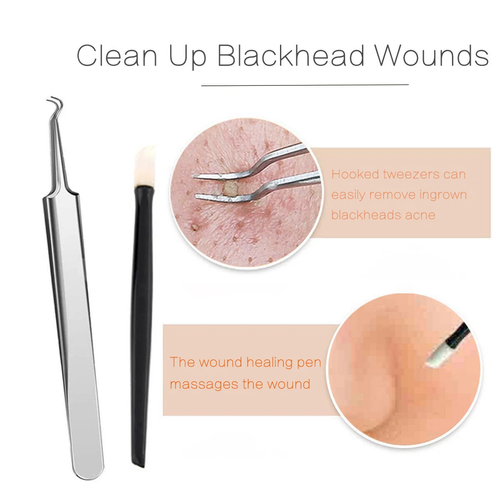 Acne Needle Blackhead Remover Pimple Blemish Comedone Extractor Tweezer Tool Kit