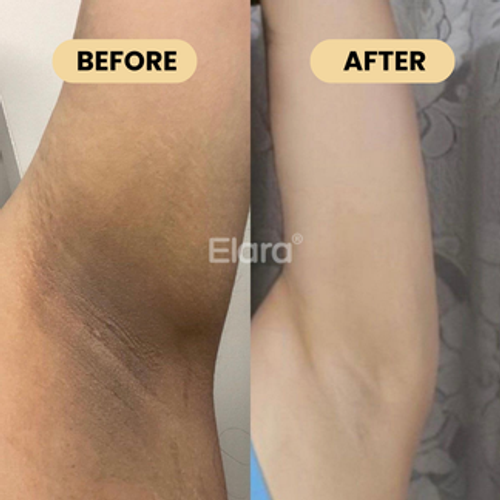 24-Hour Aluminum-Free Deodorant