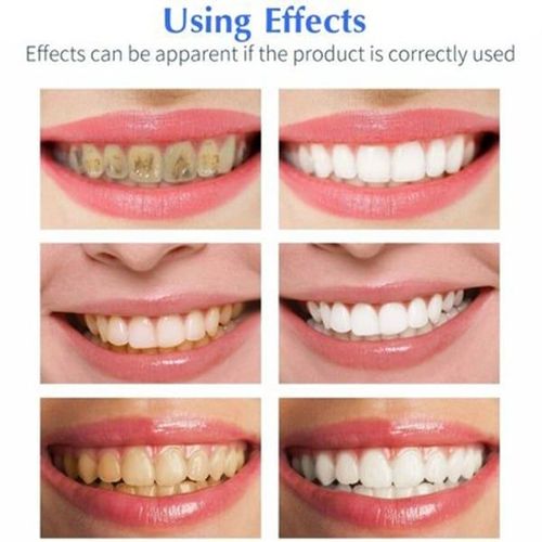 Teeth Whitening Pen