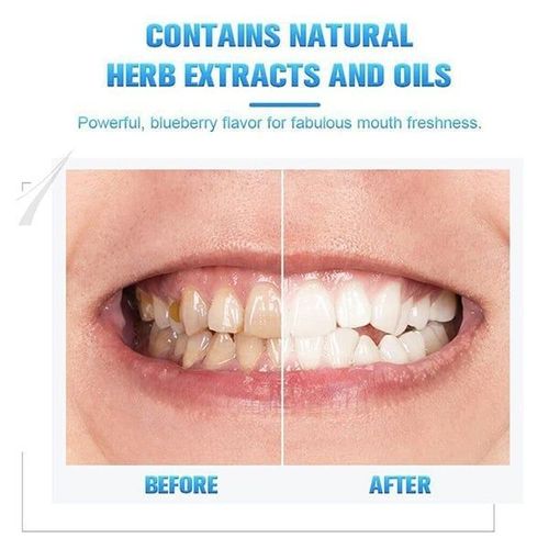 Teeth Whitening Pen