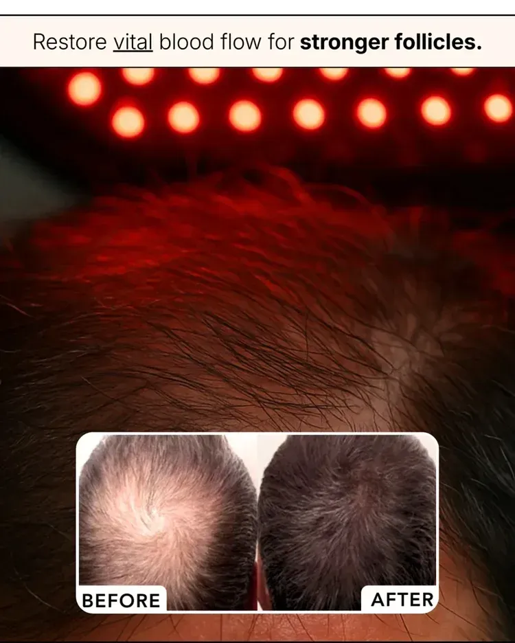 Hair Regrowth Cap