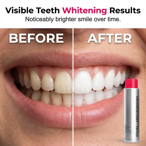 Stain‑Removing Whitening Mouthwash
