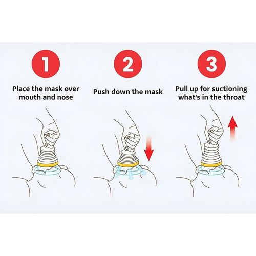 Reusable Emergency Airway Unblocker