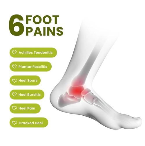Adjustable Silicone Heel Protectors