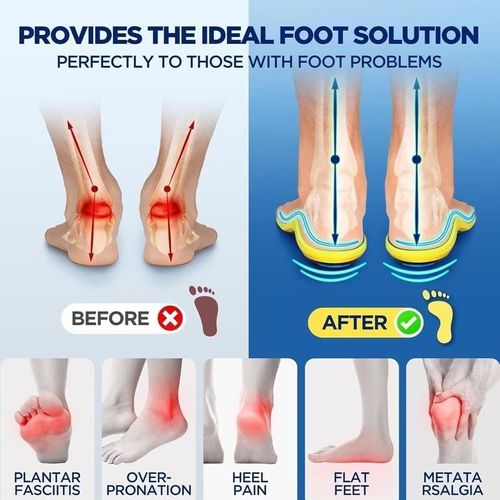 magnetic-relief-insoles