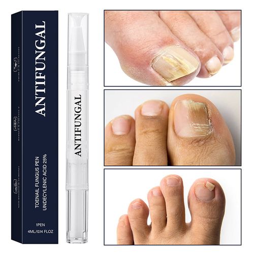 Nail fungus treatment pen for damaged nails
