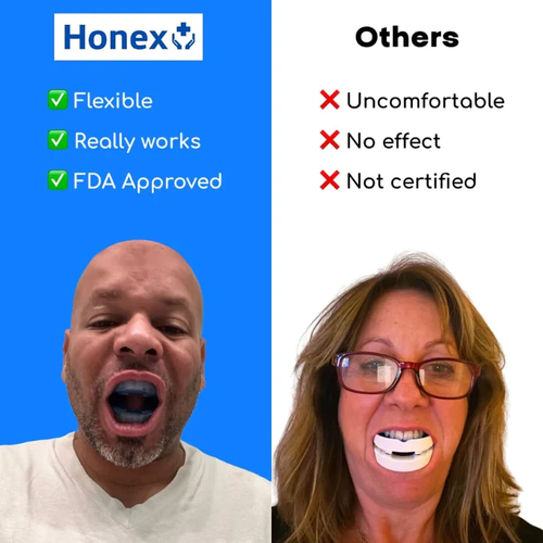 The Quiet Anti-Snoring Mouthpiece Universal Size