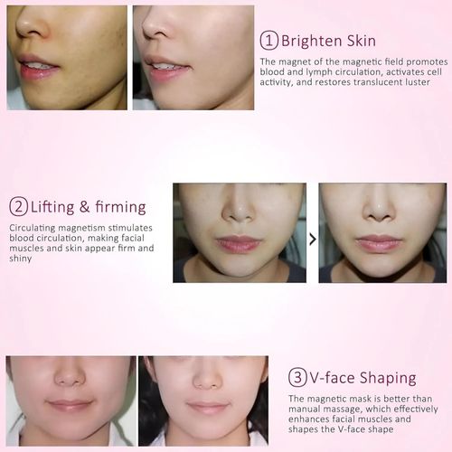 Ice Face Mask with Acupoint Magnets