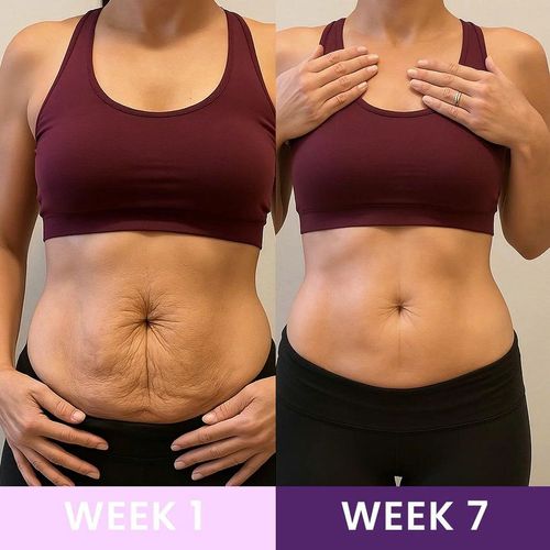 Waist Trainer | Lose Inches in Weeks