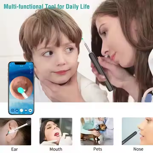 Smart HD Wireless Earwax Remover with Camera for Kids and Adults