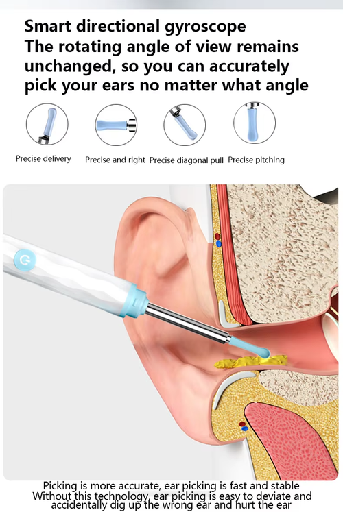 Smart HD Wireless Earwax Remover with Camera for Kids and Adults