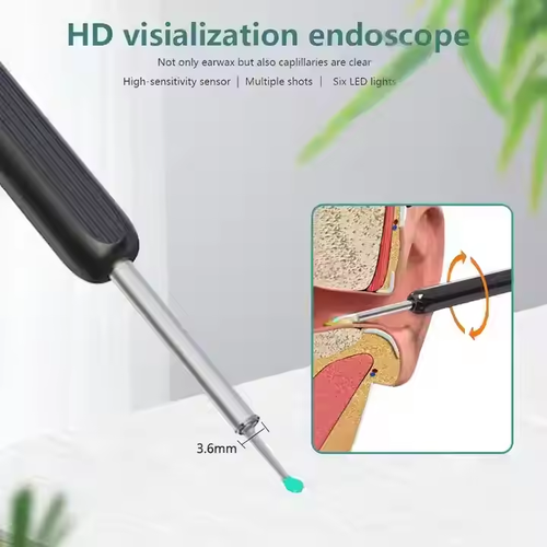 Smart HD Wireless Earwax Remover with Camera for Kids and Adults