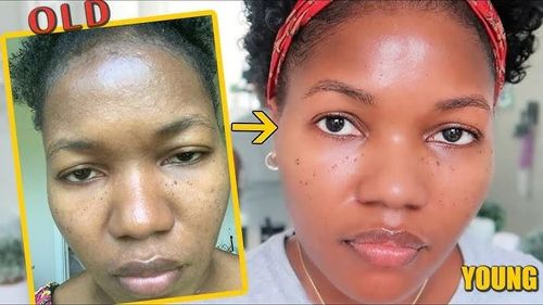 Purifying Exfoliating Gel (Buy 1 Get 1 Free)