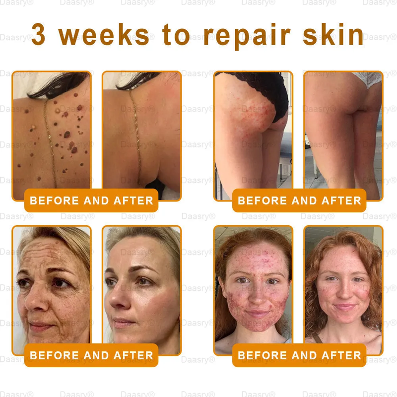 Made IN USA - Botox Bee Venom Skin Restoration Cream