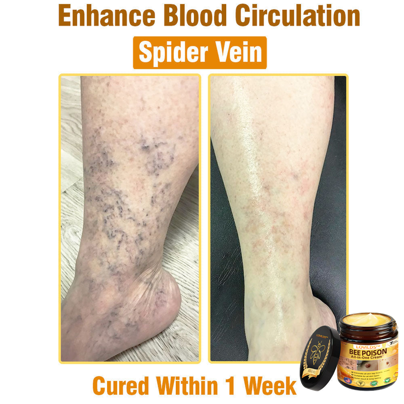 LOVILDS™ Bee Poison All-in-One Cream US Dermatologist Approved