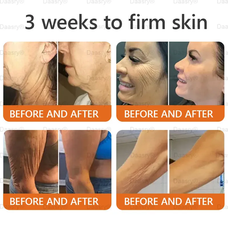 Made IN USA - Botox Bee Venom Skin Restoration Cream