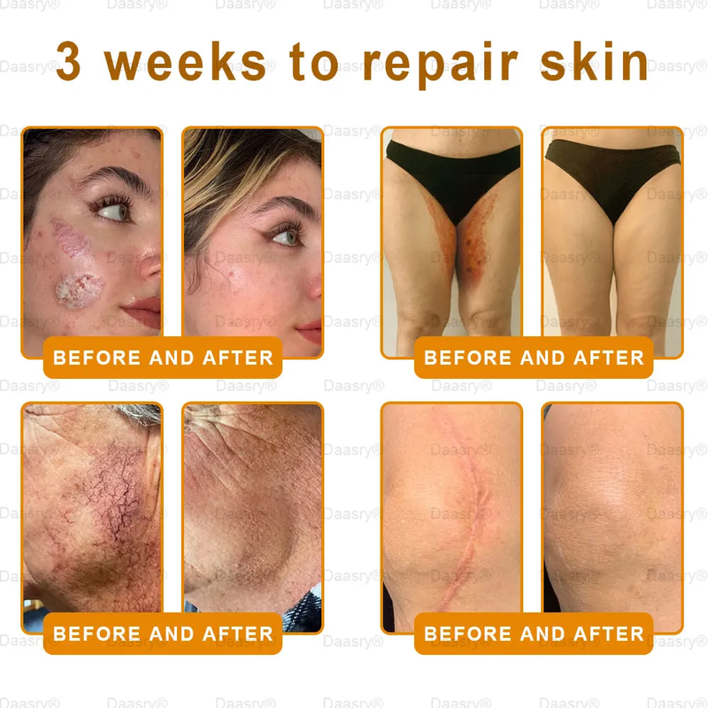 Made IN USA - Botox Bee Venom Skin Restoration Cream