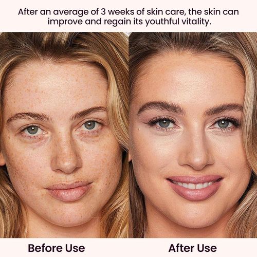 Face Skincare Device, For Smoother, Glowing Skin, Pink