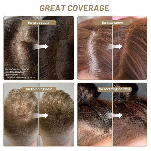 Hairline Powder Root Touch Up Hair Color, Instant Hairline Powder for Thinning Areas and Gray Hair Coverage, Natural and Non-greasy Root Cover up for Women and Men