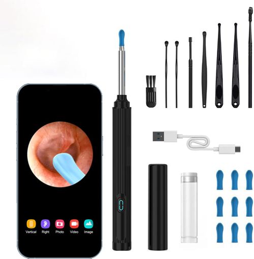 Smart Illuminated Ear-Cleaning Tool with HD Endoscope