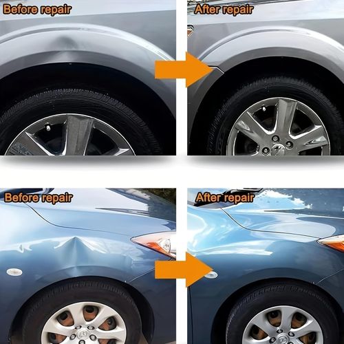 Car Dent Puller Kit, Paintless Dent Repair Tools, Car Body Dent Removal Tool, Car Dent Repair Kit with Hammer