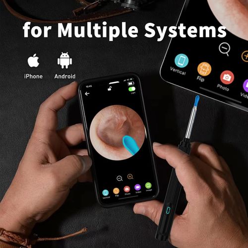 Smart Illuminated Ear-Cleaning Tool with HD Endoscope
