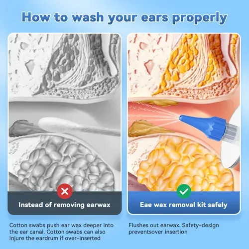 Ear Wax Removal Tool, Ear Flushing Kit for Adults & Kids, Safe and Effective Earwax Remover, Manual Ear Cleaner Earwax Removal Kit with 2 Types of Ear Tips