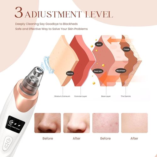 2026 Pore Vacuum, USB Rechargeable Blackhead Remover Vacuum,3 Levels Adjustable Pore Vacuum Blackhead Remover, with 5 Suction Power,Face Vacuum Pore Cleanser for Women & Men-White